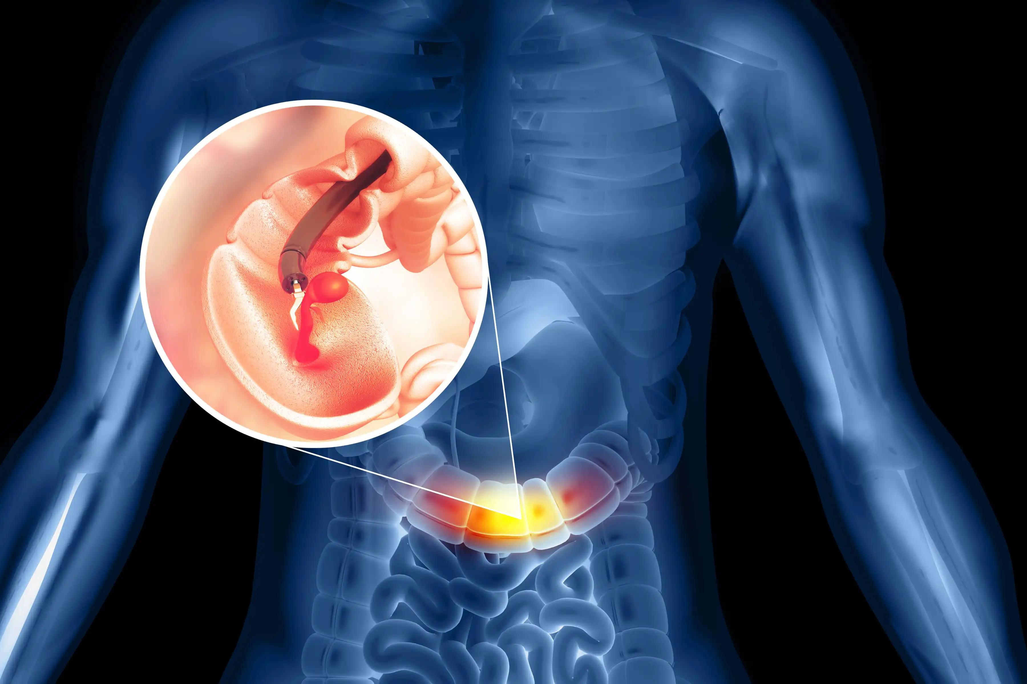 3d Illustration of Stomach Endoscopy