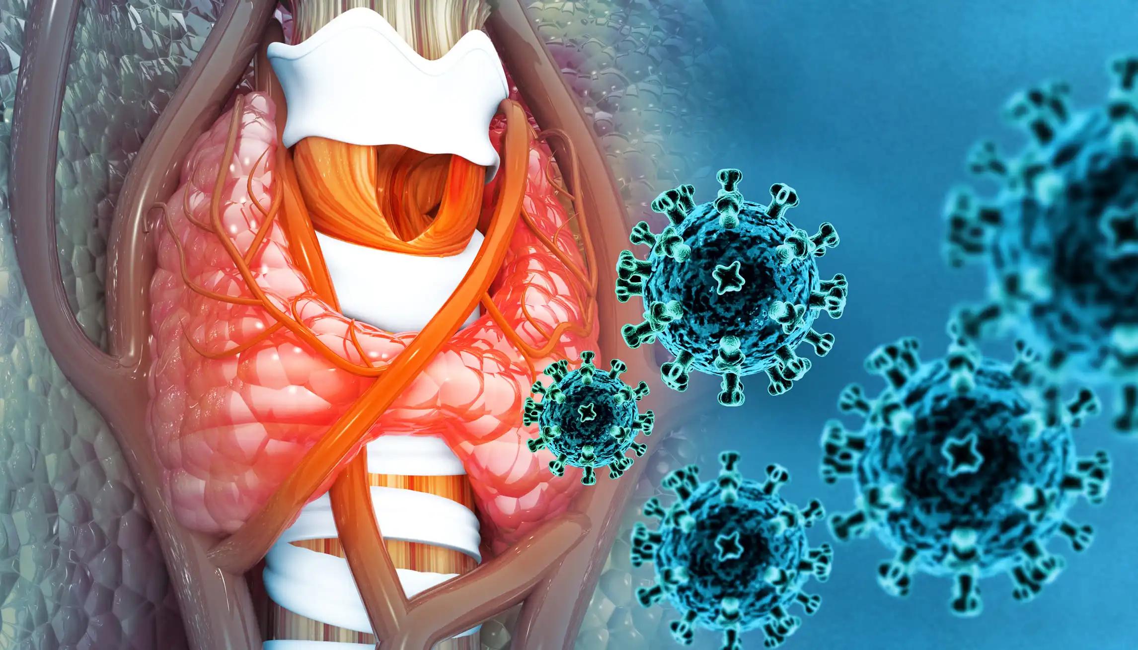 3d illustration Virus Infected Thyroid Gland