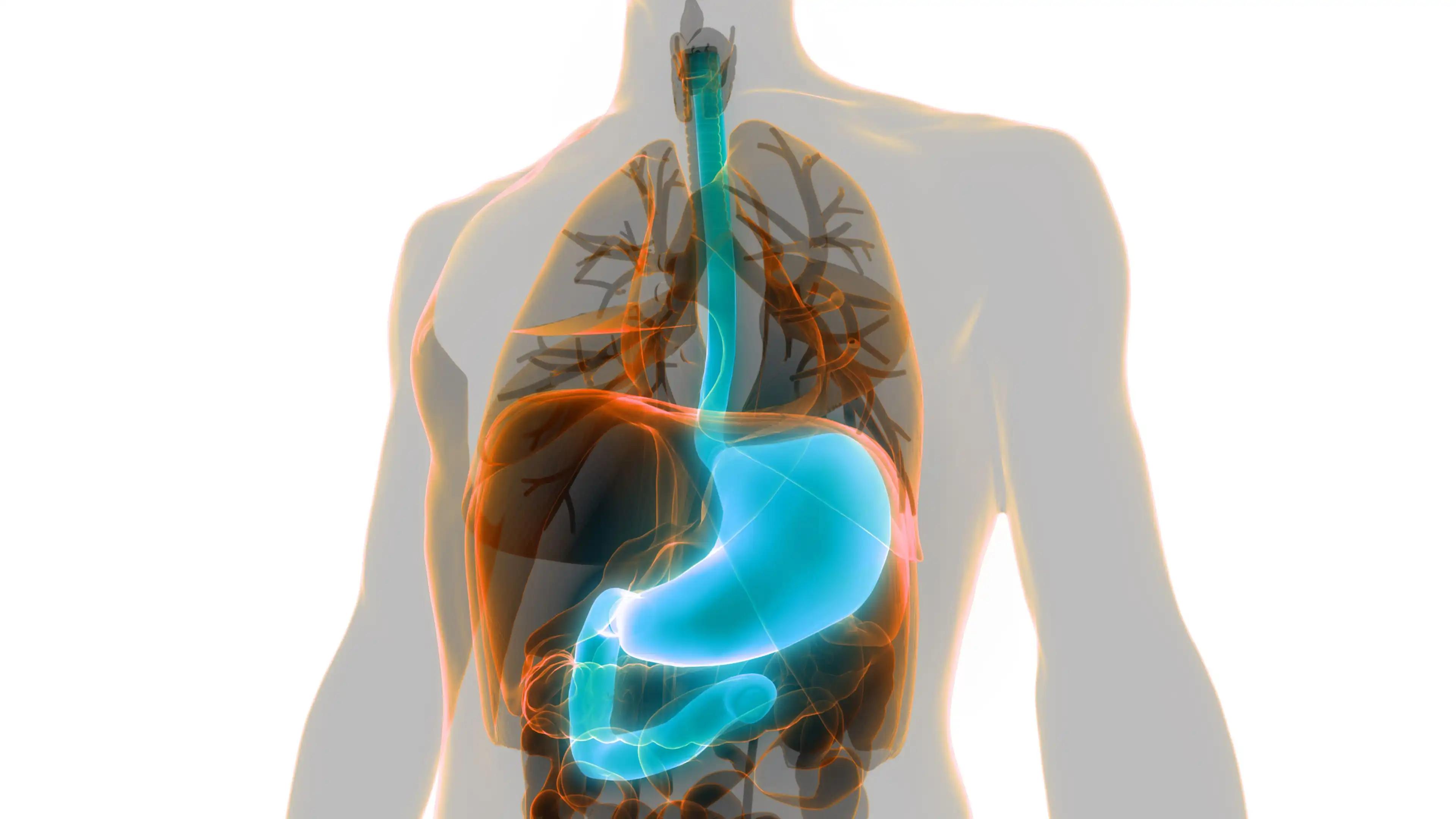 3D VIew Of Stomach in Pancreatic Cancer