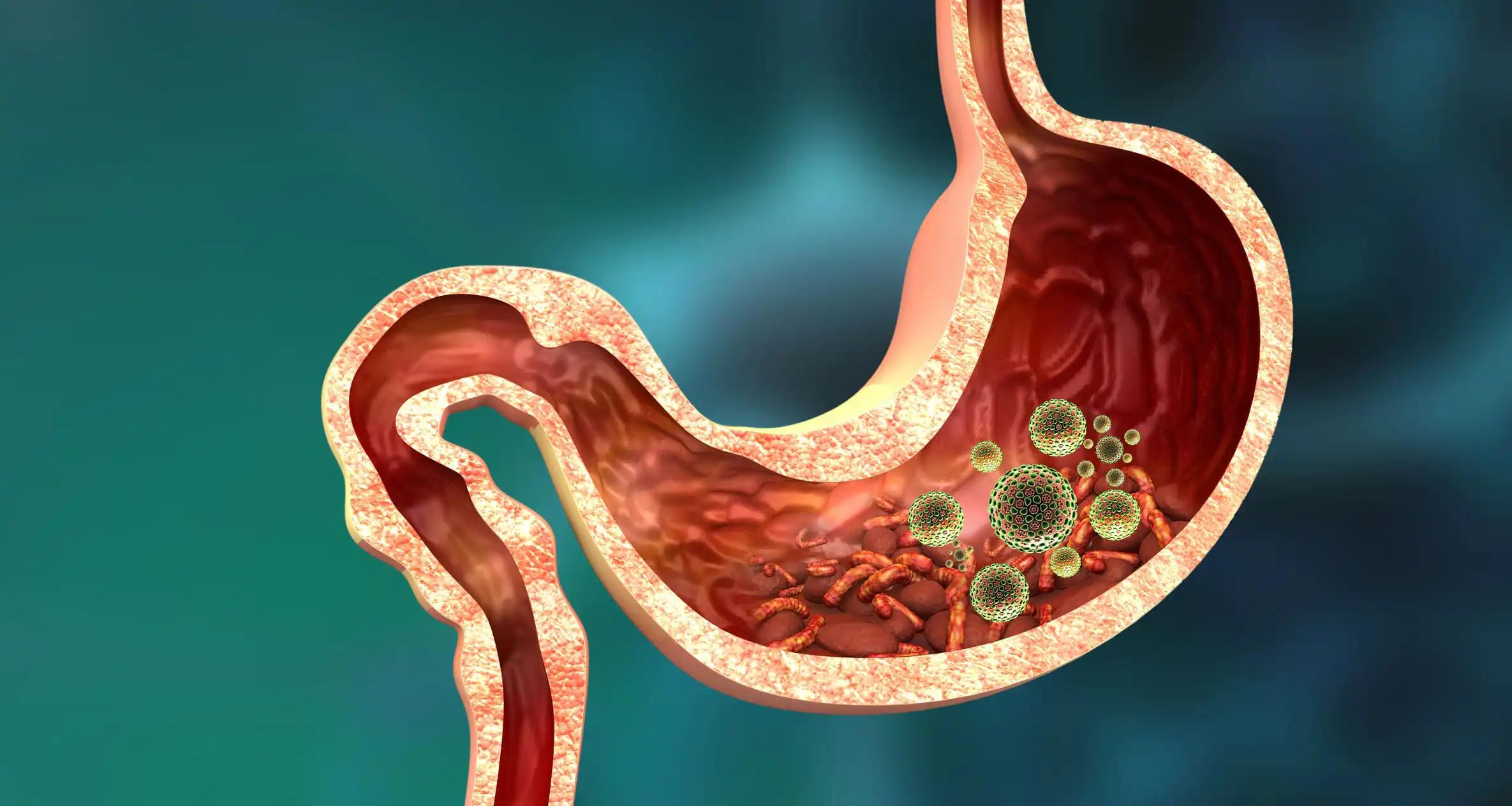 3D View of Stomach with Viruses and Bacteria