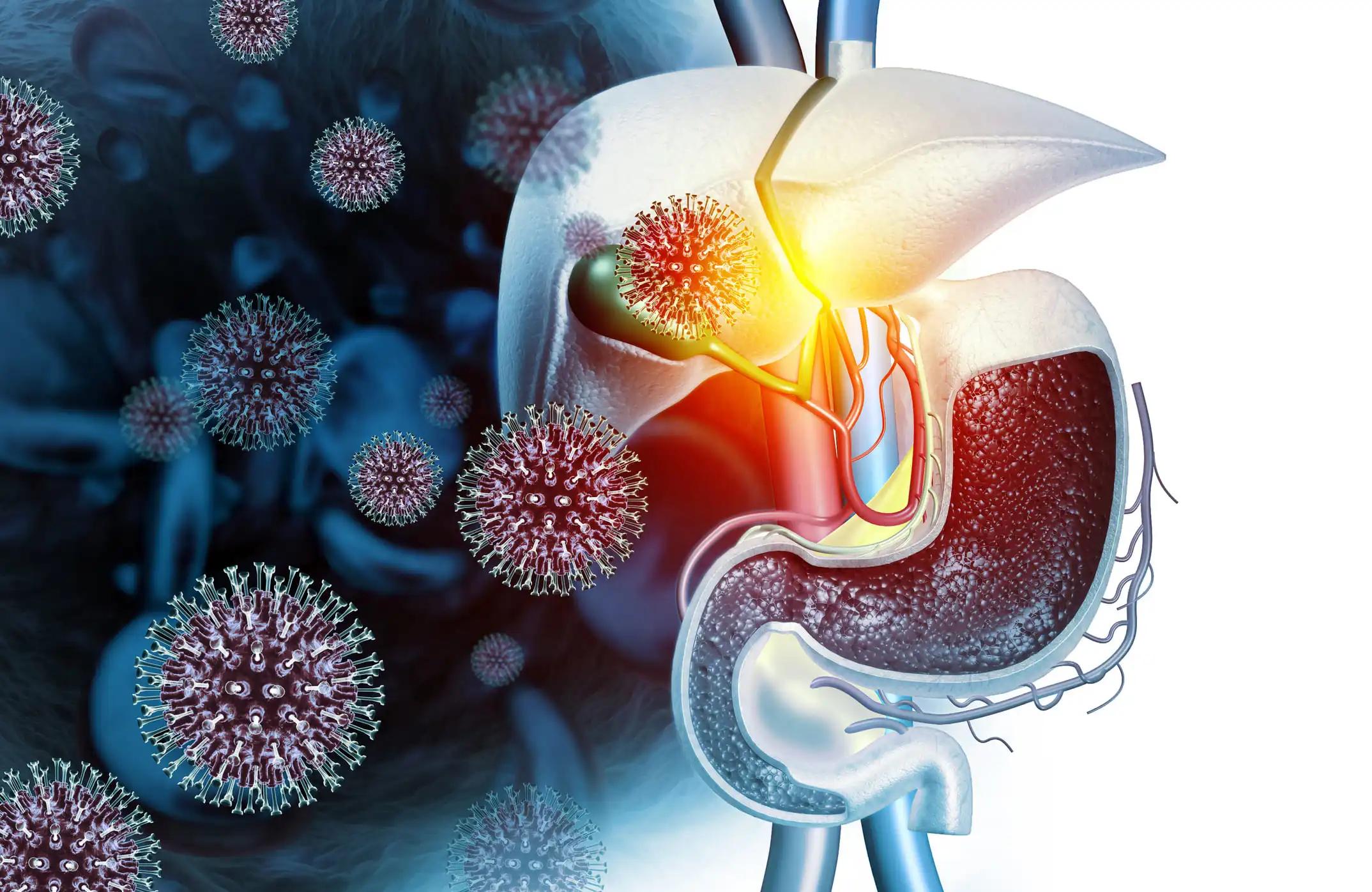 3d View of Topical Actinic Keratosis Cancer 