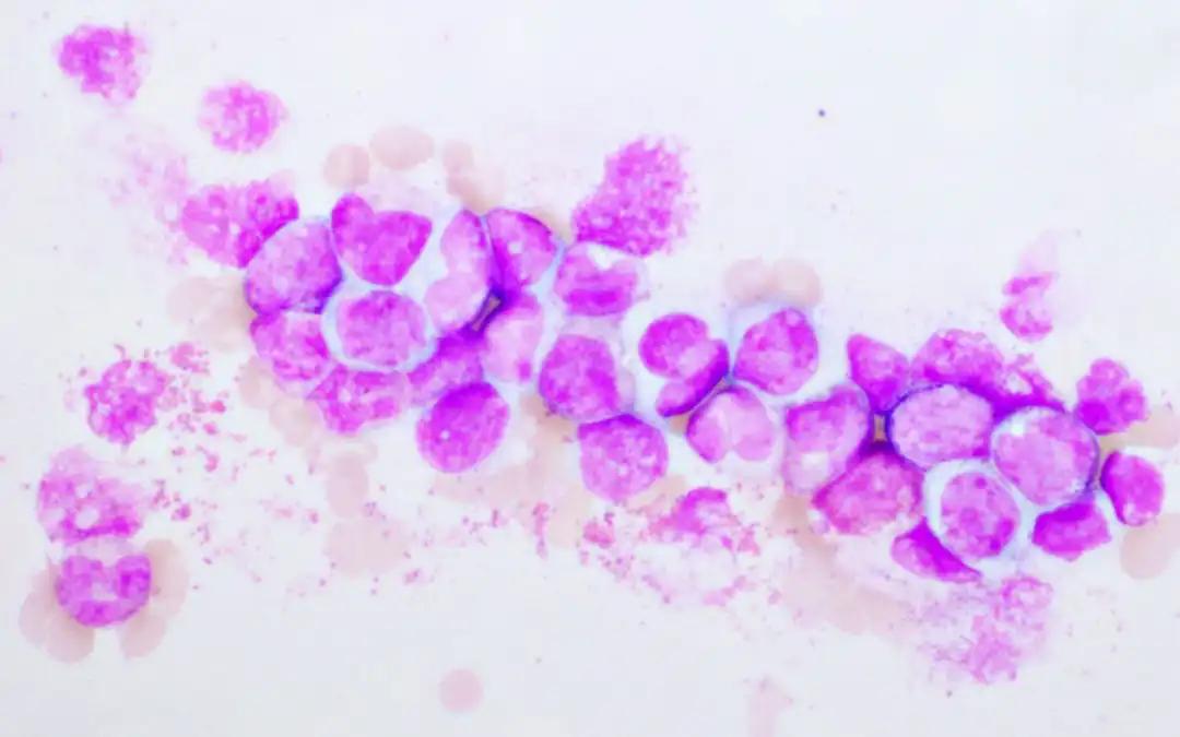 Imatinib Combo Enhances Antioxidant Defense in Leukemia Cells