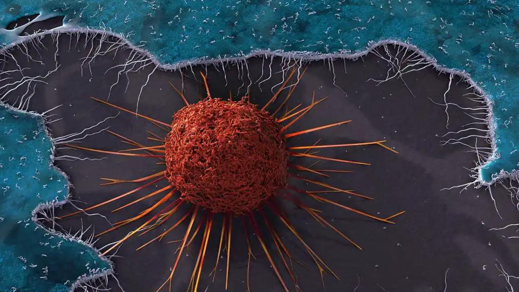 SEM Style 3d Rendering of Cervical Cancer Cell