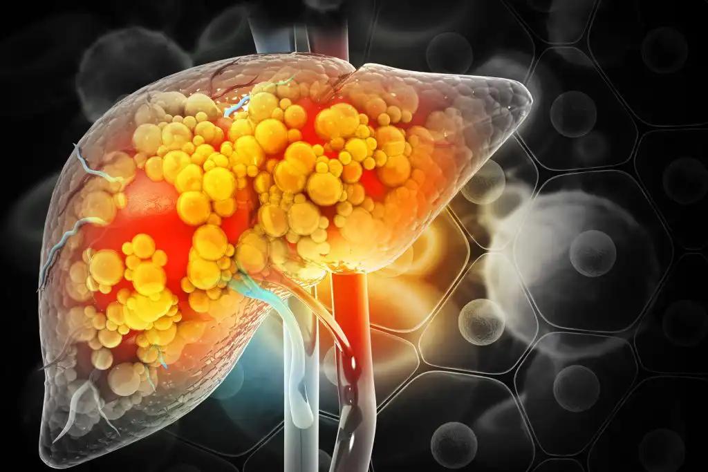 Lipid Metabolism in Liver Cancer