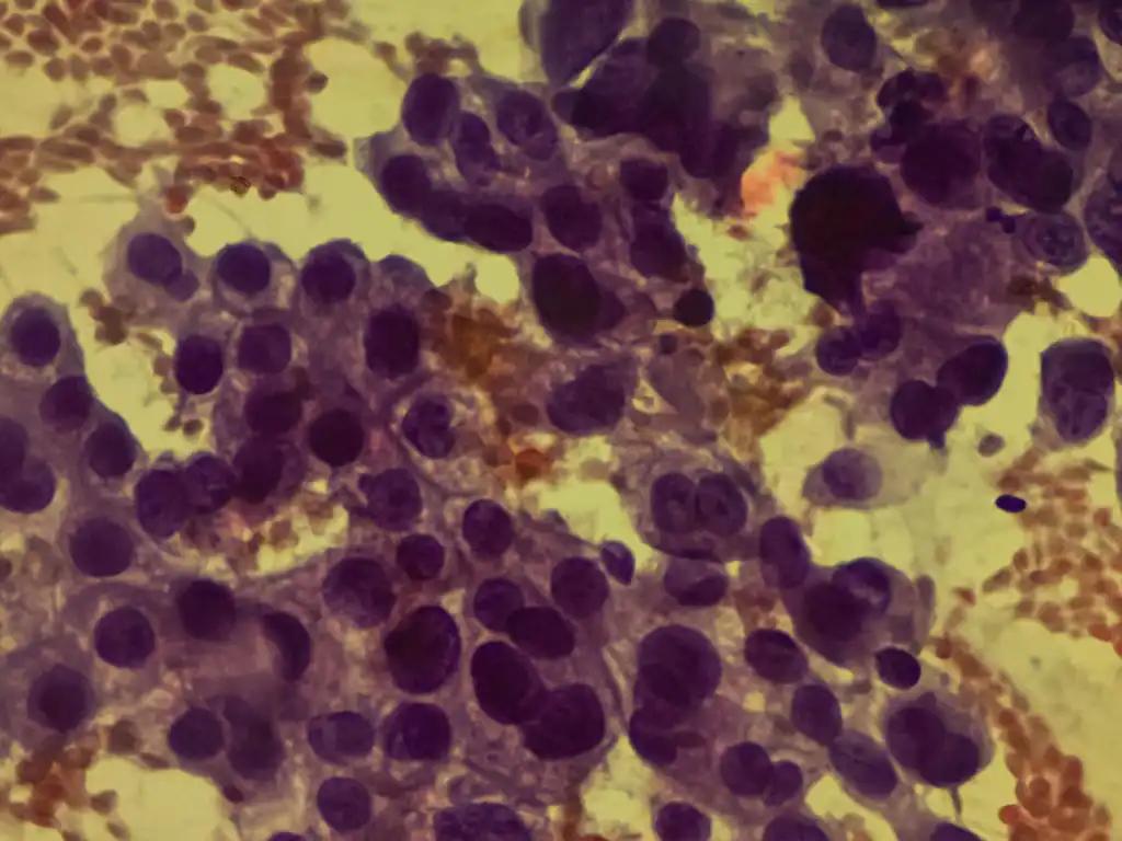 Triple Negative Breast Cancer Cells