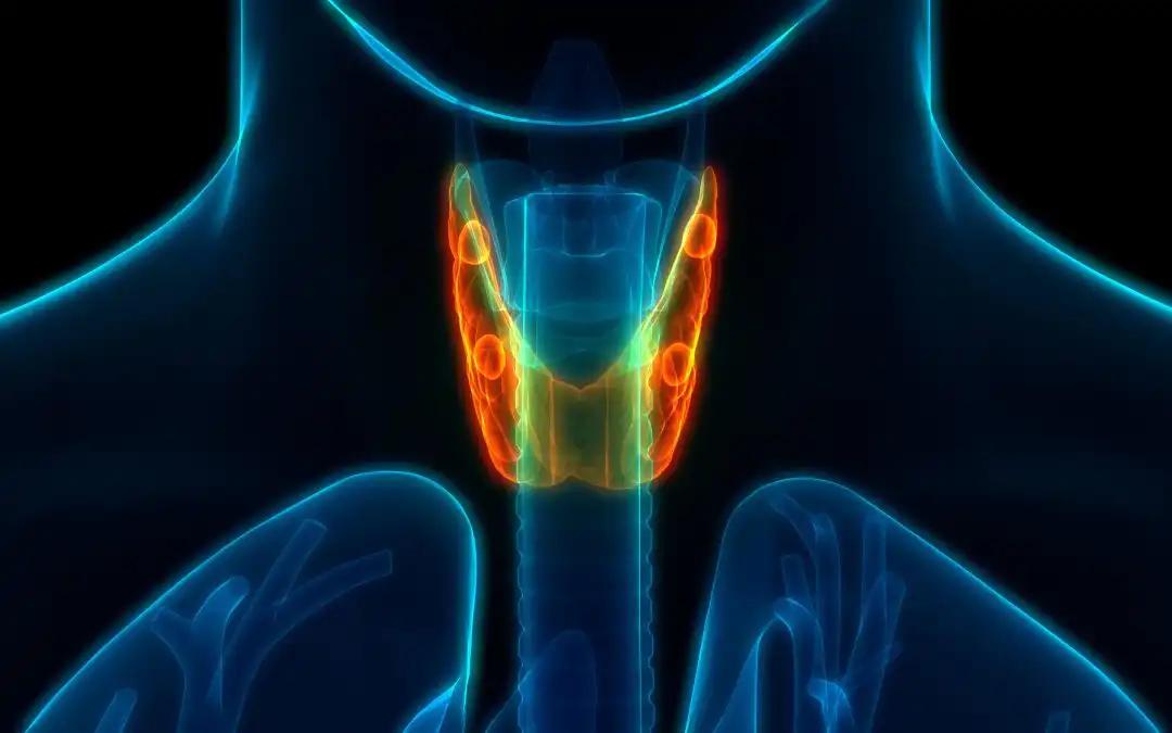 Single vs Multiple Intercostal Ports in Esophageal Cancer Surgery