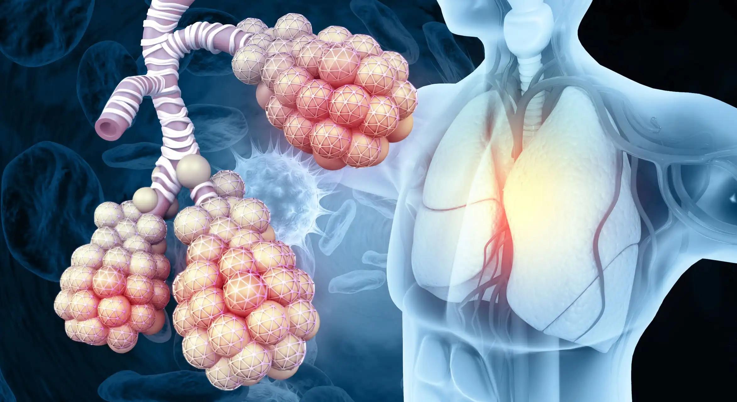 Alveoli in Lungs Tiny Air Spaces