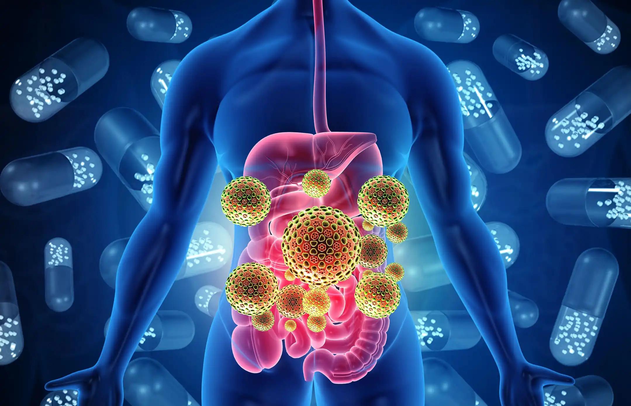 Bile Duct Cancer (Cholangiocarcinoma)