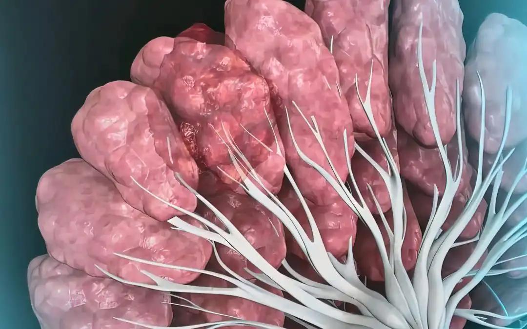 Impact of Metformin on OS in mHSPC: STAMPEDE