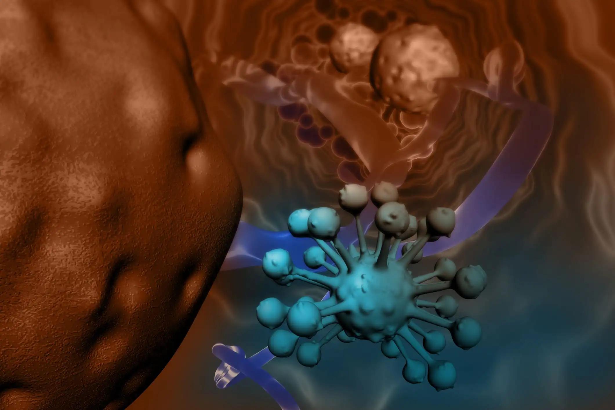 Cancer Cell Infection in Intestinal Vili