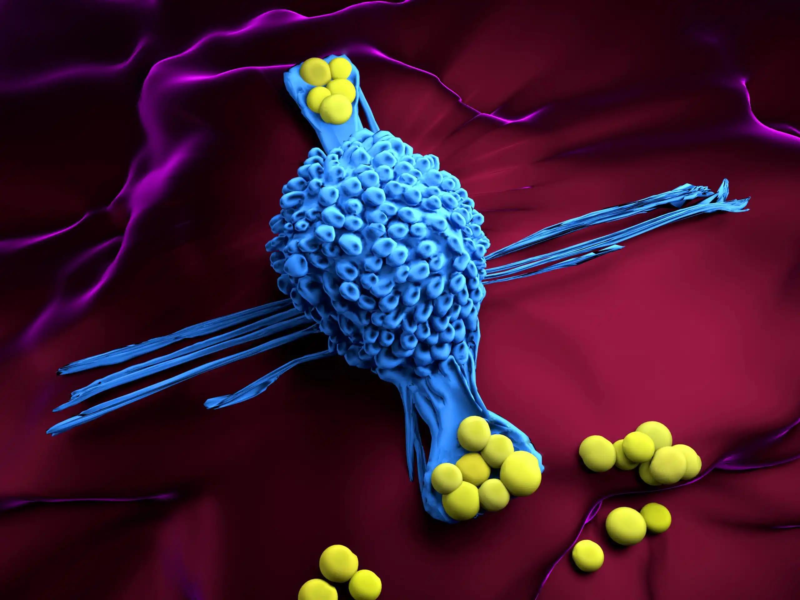 Chemo Radiation for Non-Small Cell Lung Cancer 