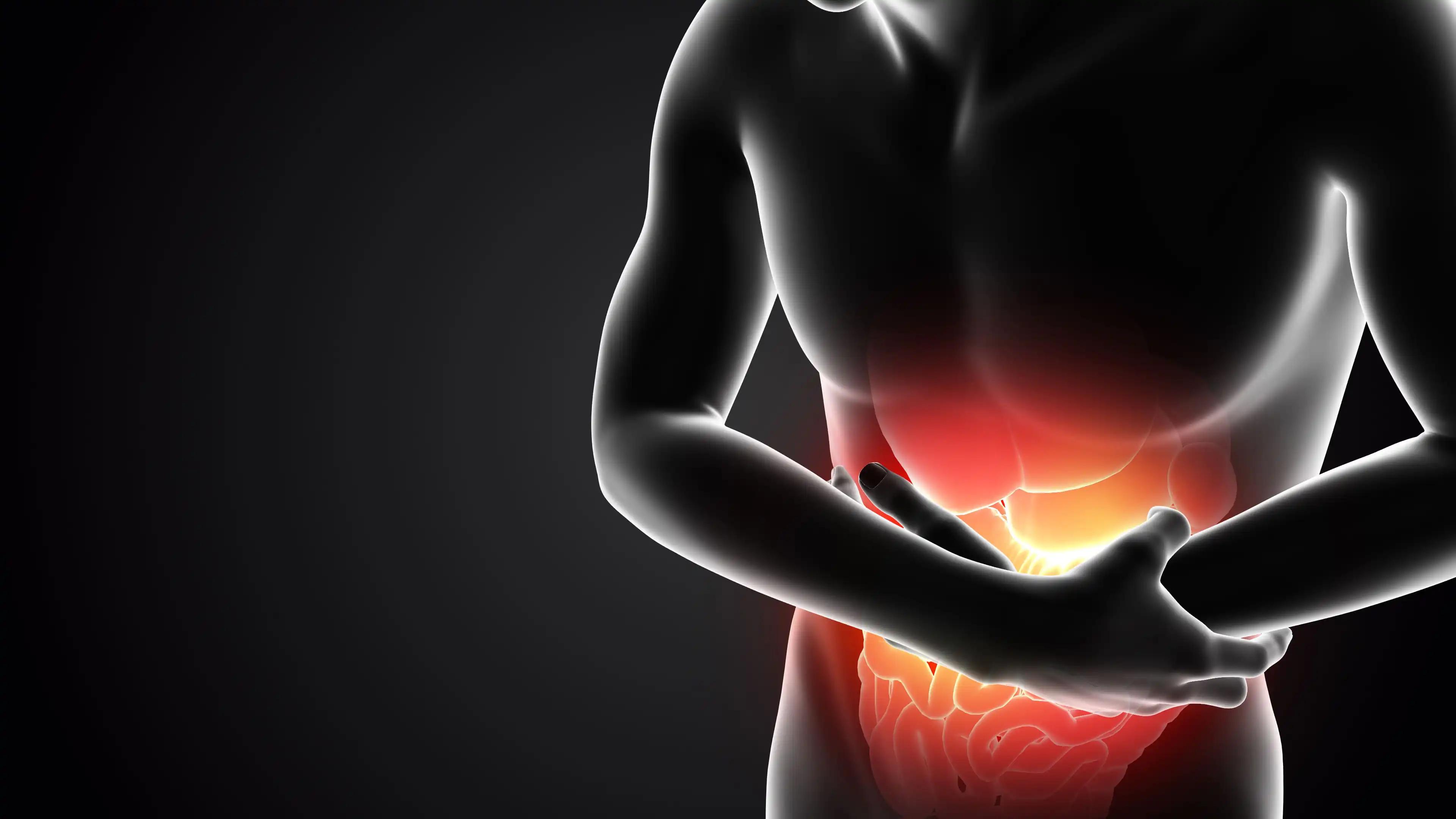 Gastric Cancer in Stomach 3D