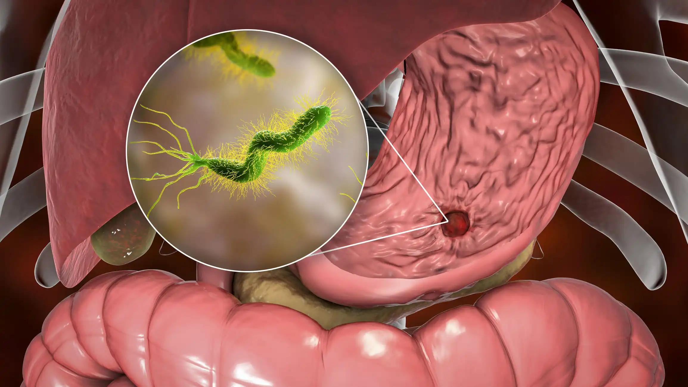 Proapoptotic Potential of MAC-NCs in Gastric Cancer Cells