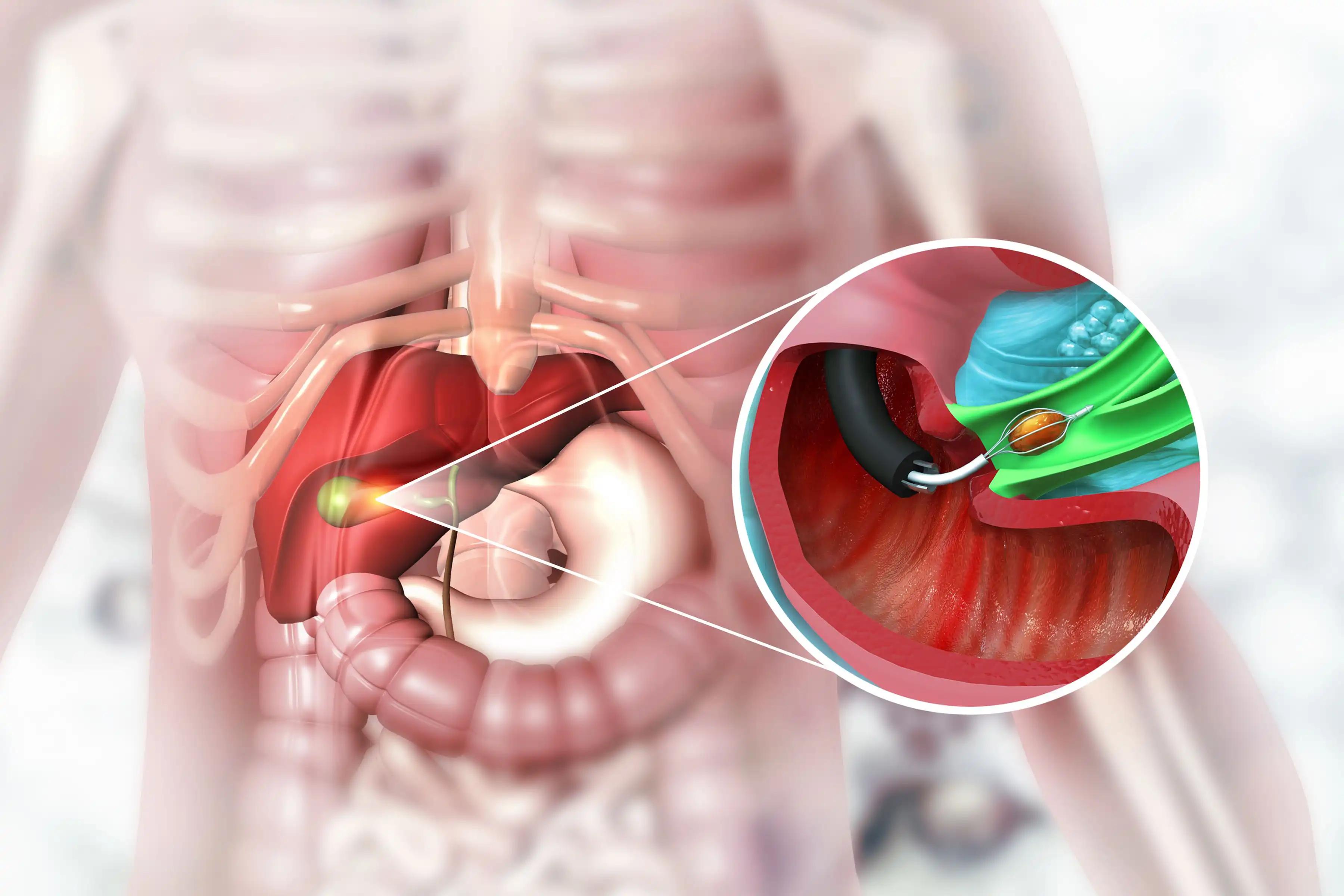 Genitourinary Cancer