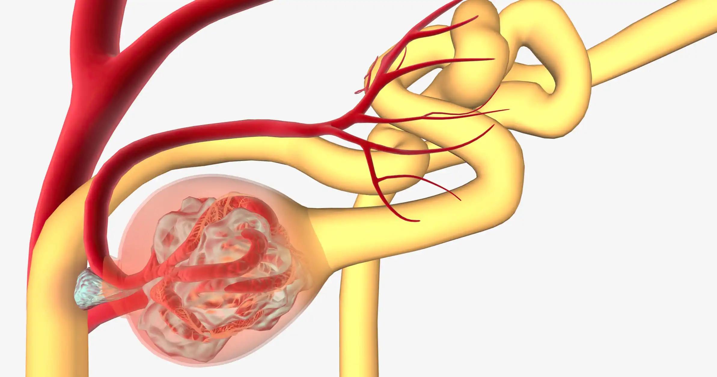 Glomerulonephritis Renal Inflammation