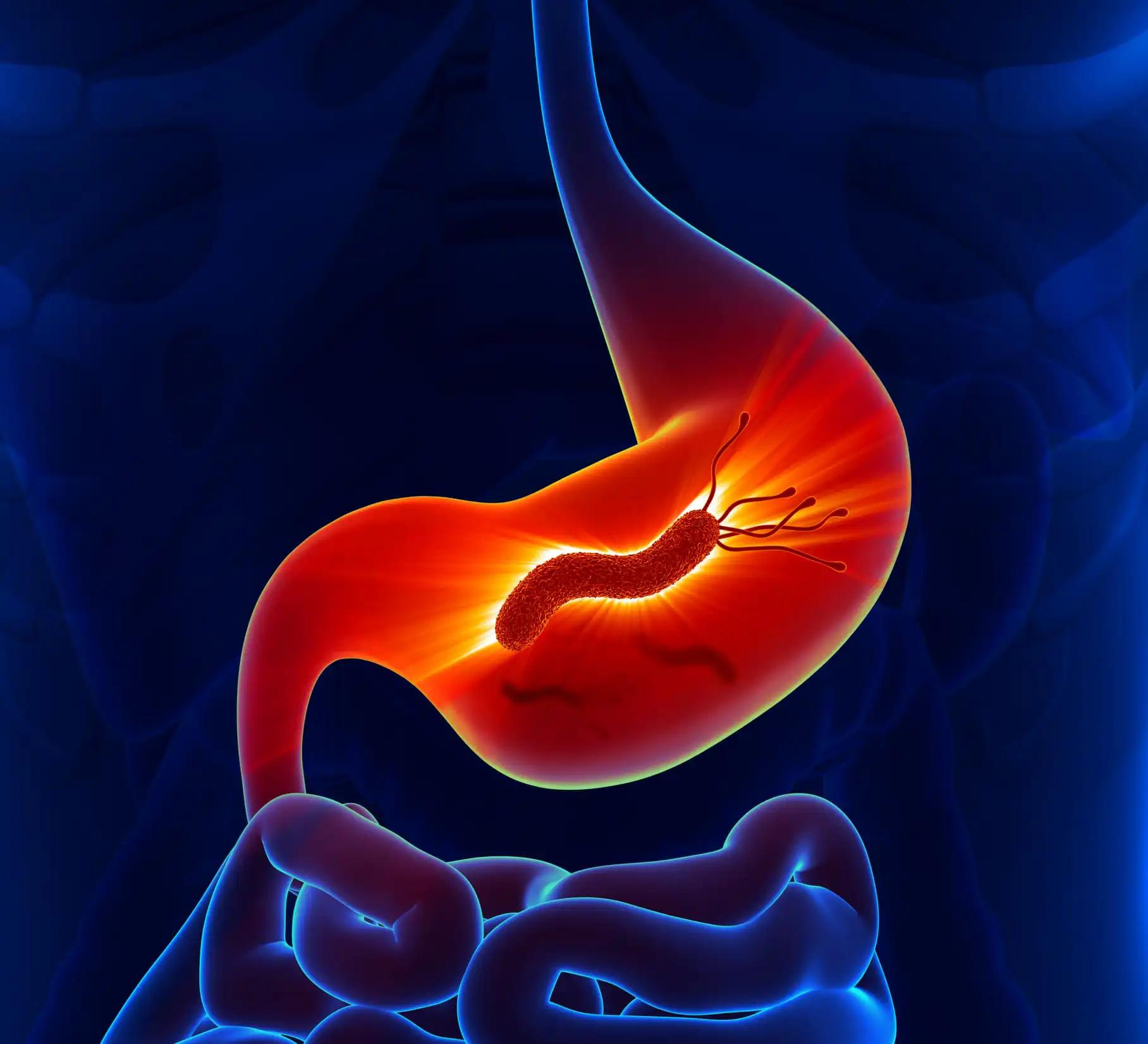 Helicobacter Pylori Bacteria in Small Intestine