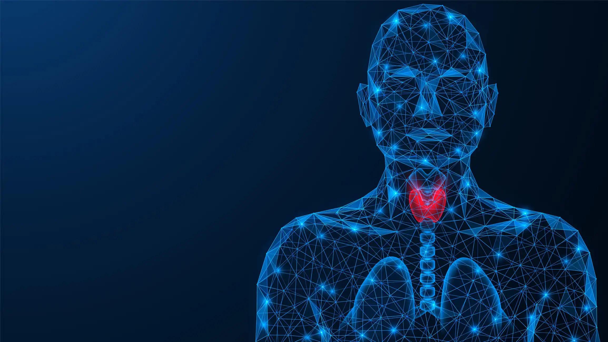 Illustration of Inflamed Thyroid Gland Lymphoma