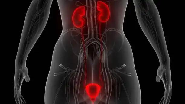 Kidneys and Urinary Tract Infection