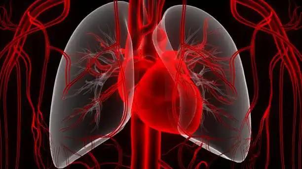 Lung Cancer Mass on CT scan