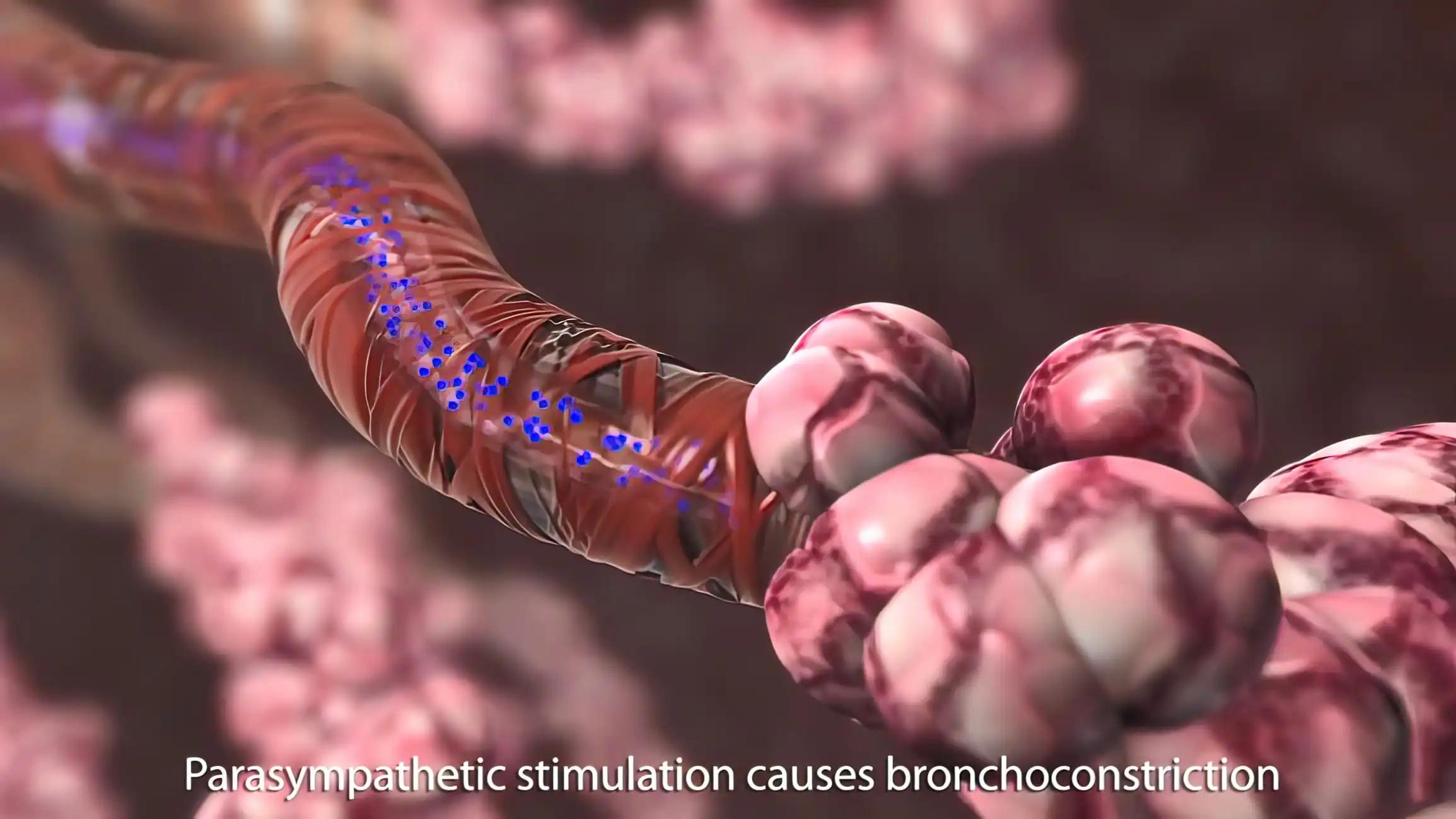 Microscopic view of bladder cancer cells