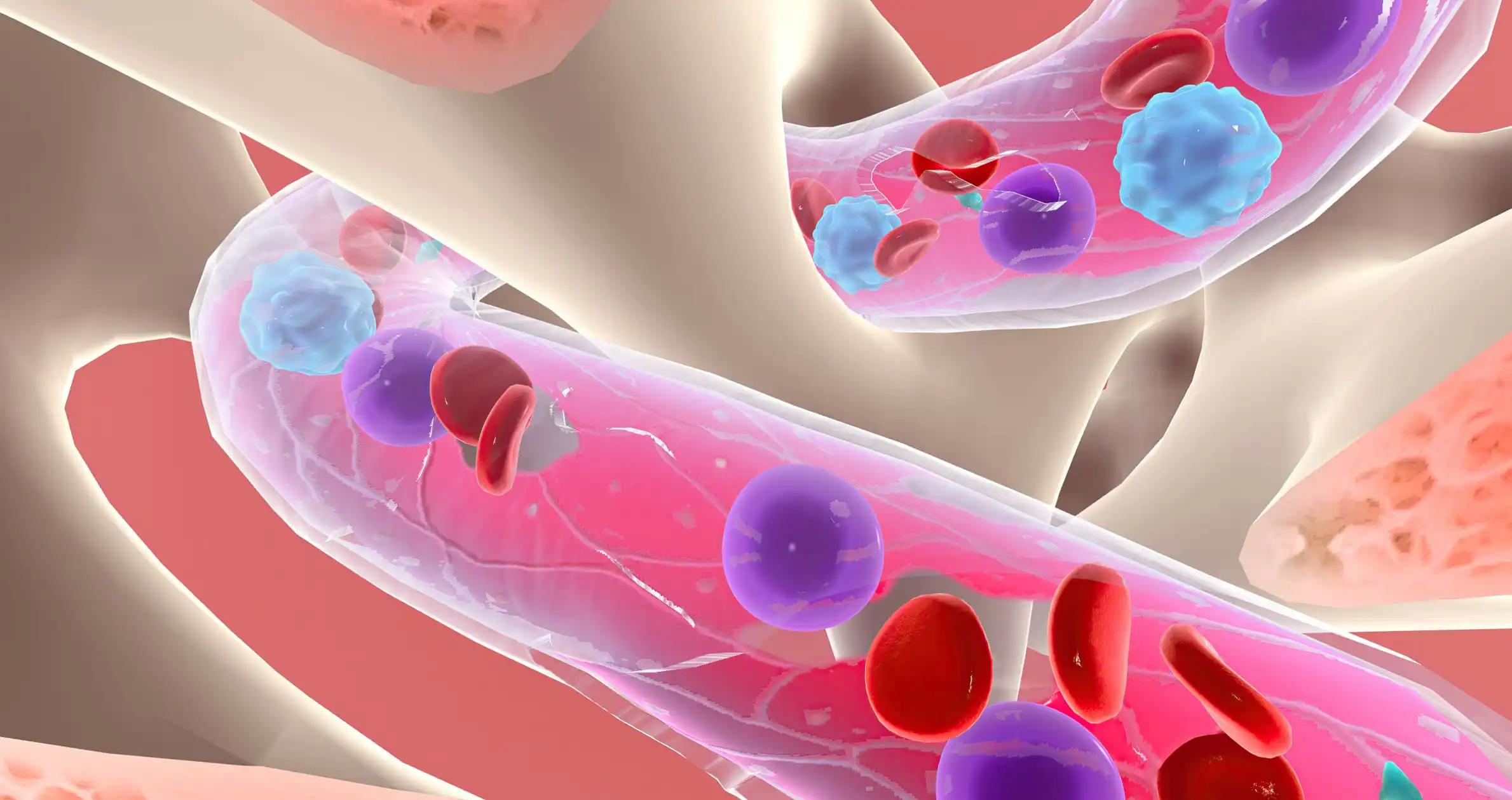 Microscopic View of Lymphoblasts in Bone Marrow