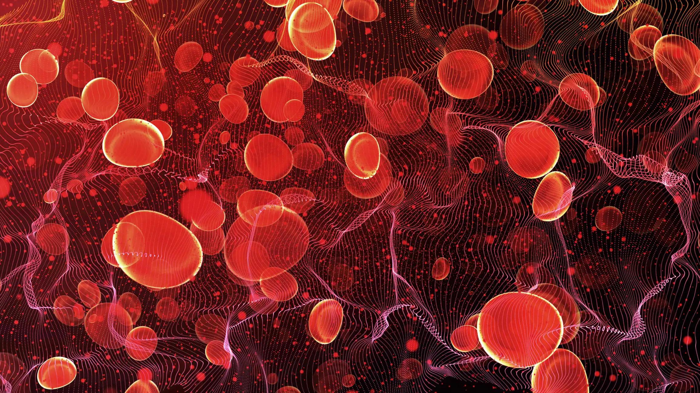 Myelofibrosis Red Blood Cells