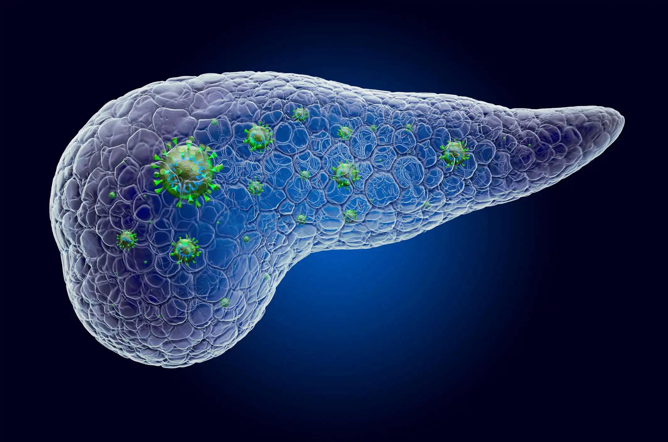 Pancreas with Cancer Virus Infection