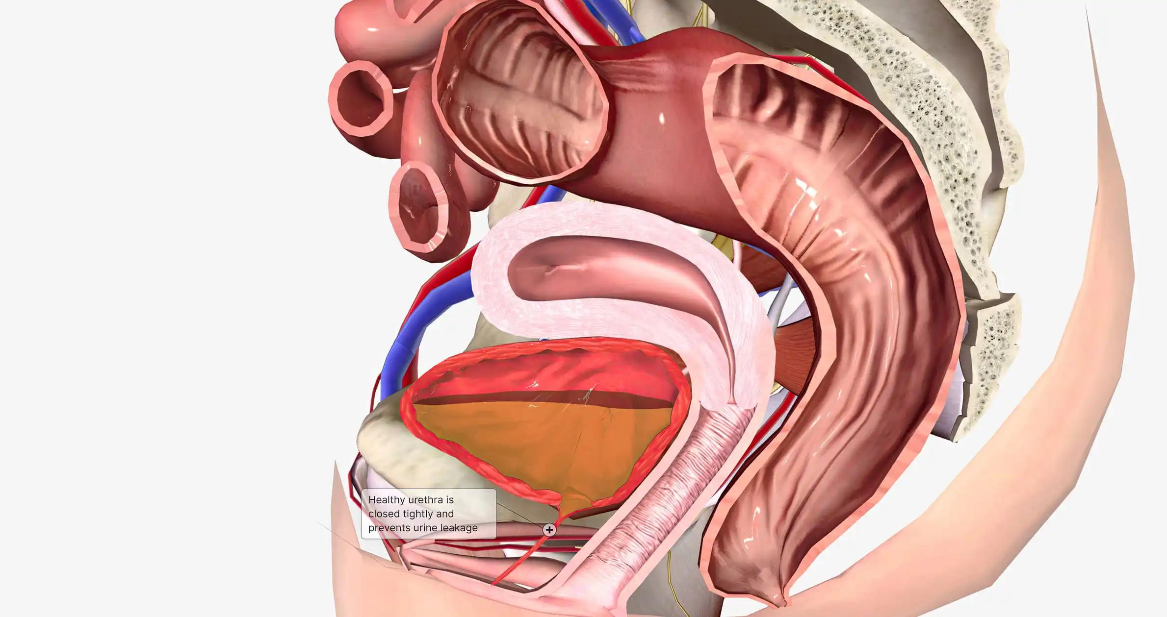 Prolapse Cystocele Female