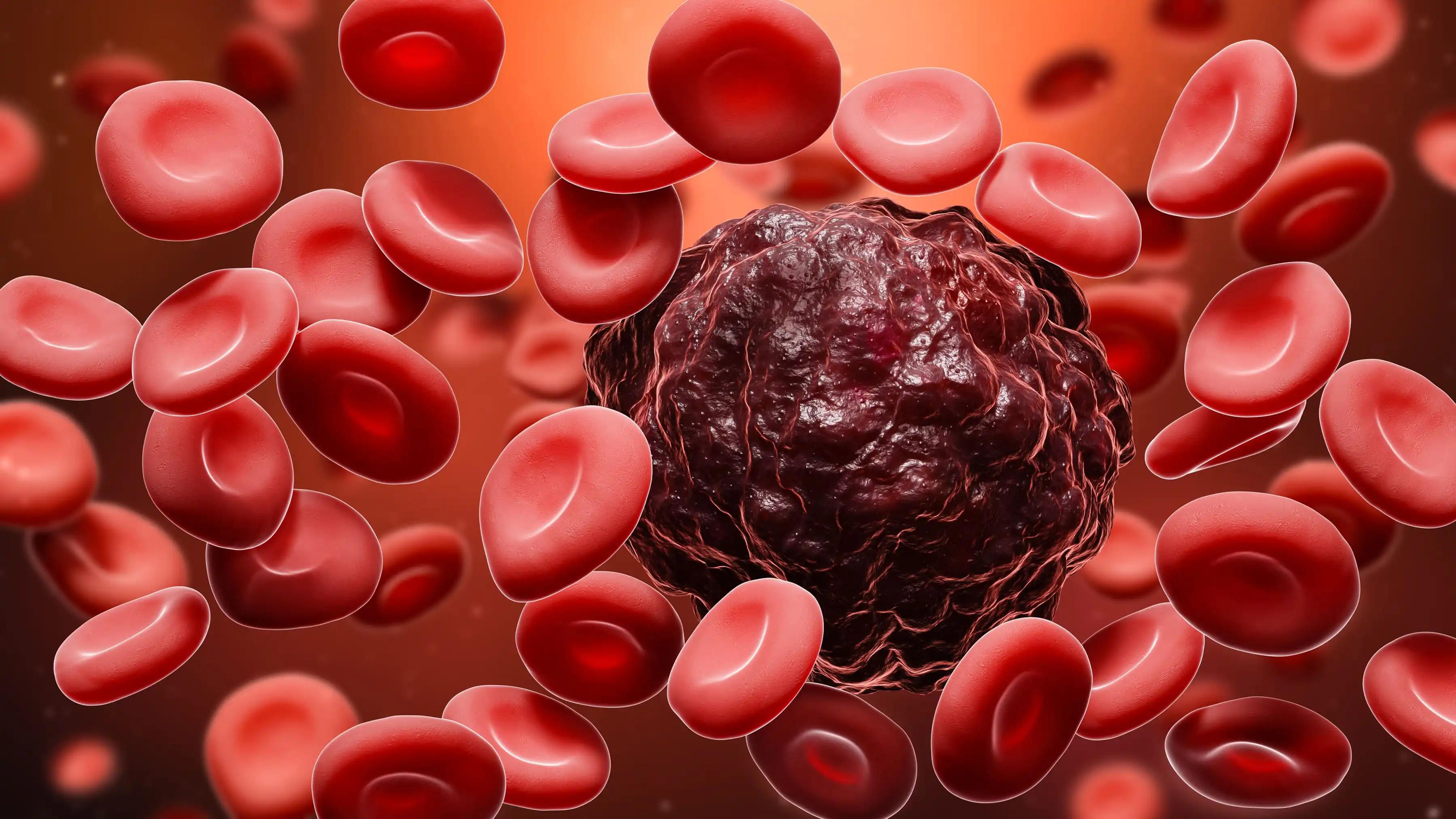 Red Blood Cells Around The Sarcoma Tumor