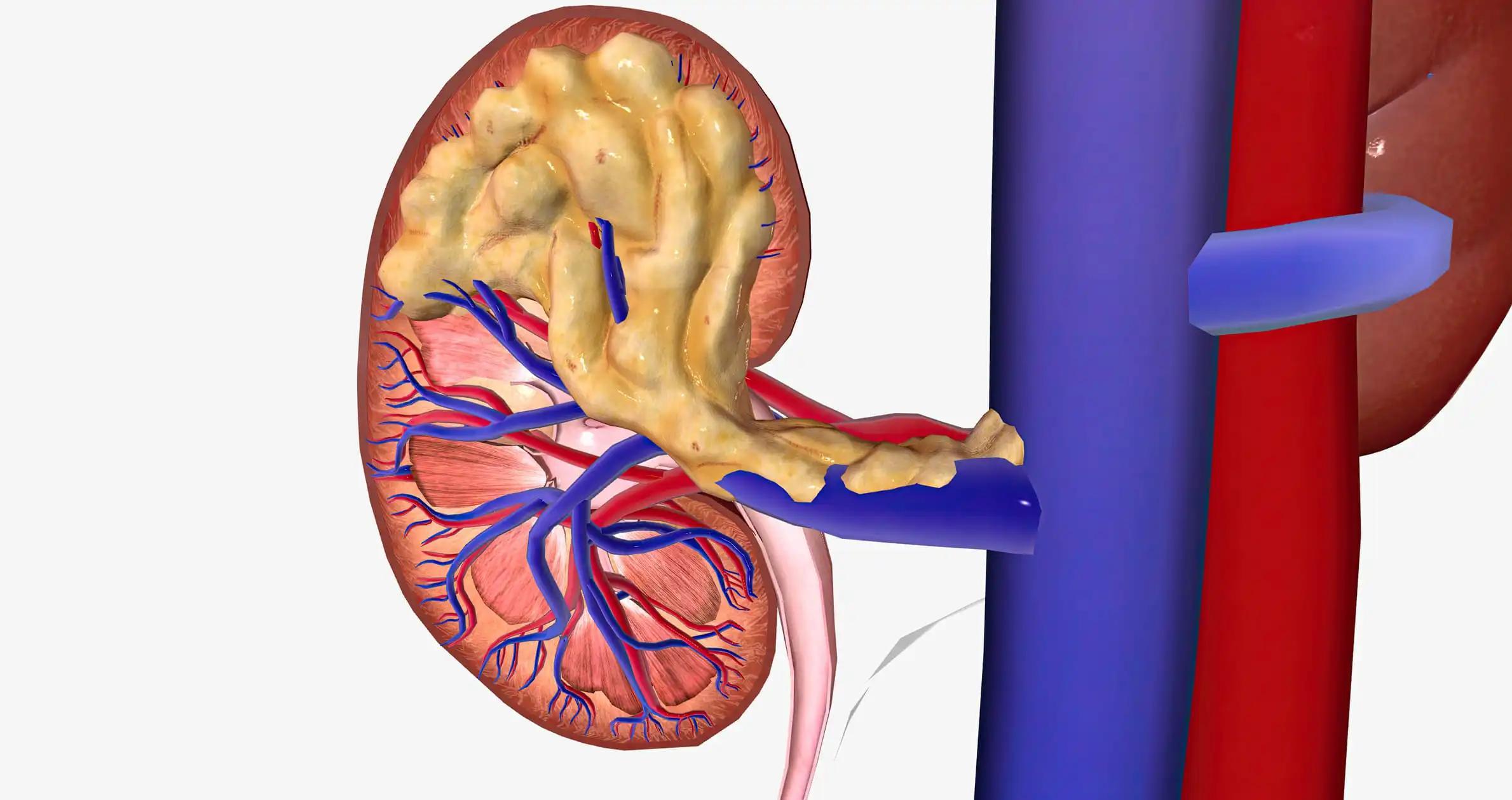 Surrogate Endpoints in mCRPC