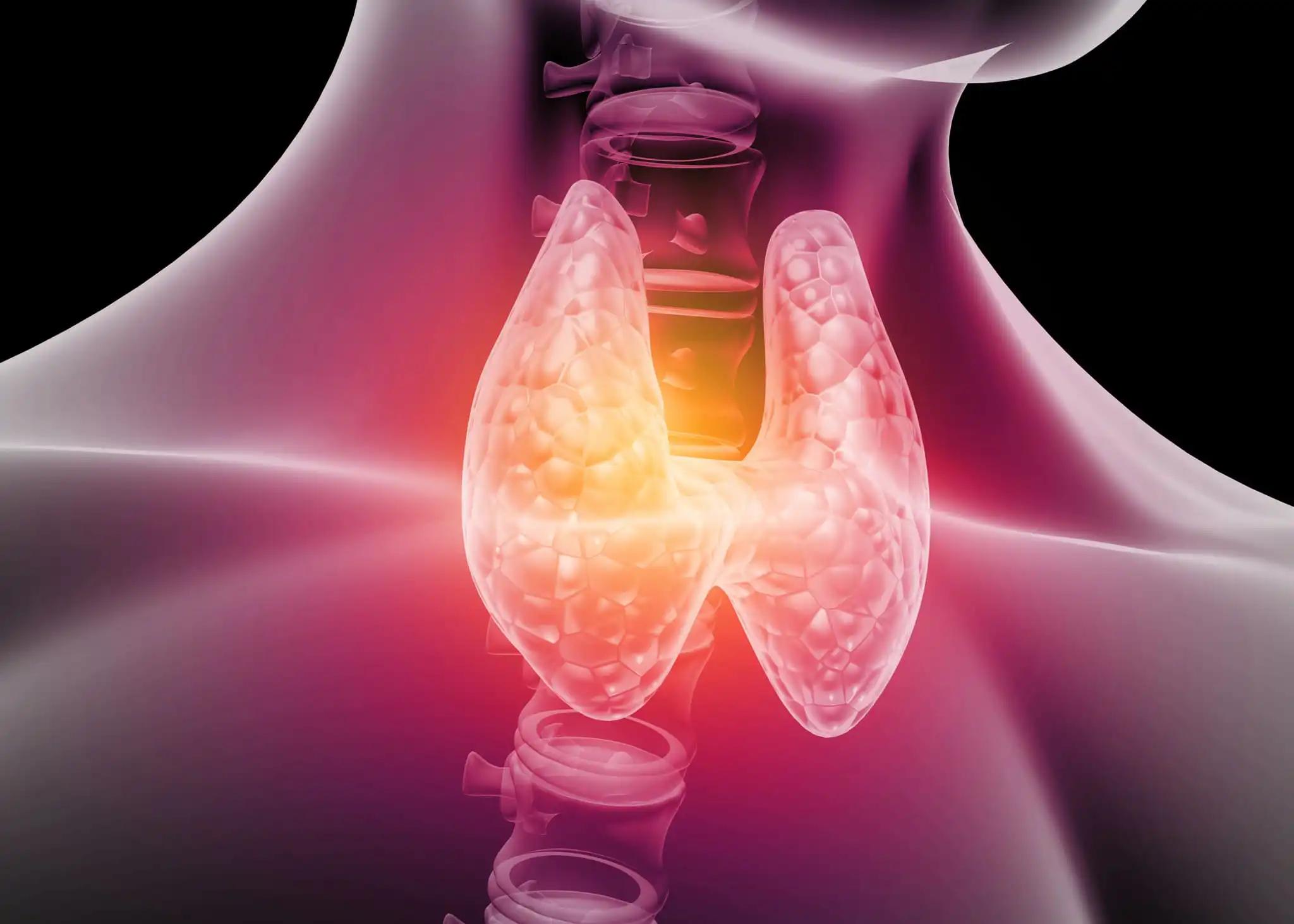 Thyroid Nodules