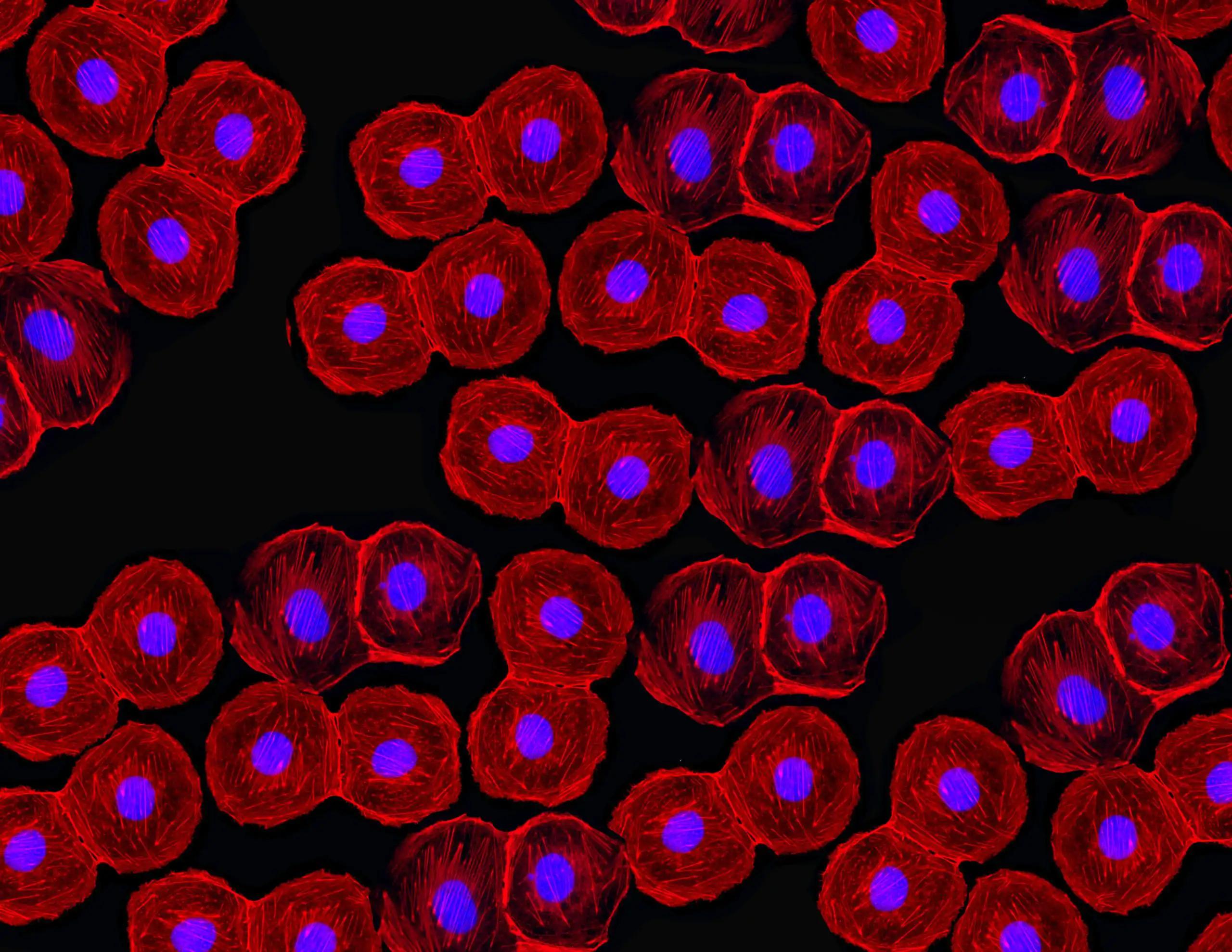 Risk Factors in the Stem Cell Therapy