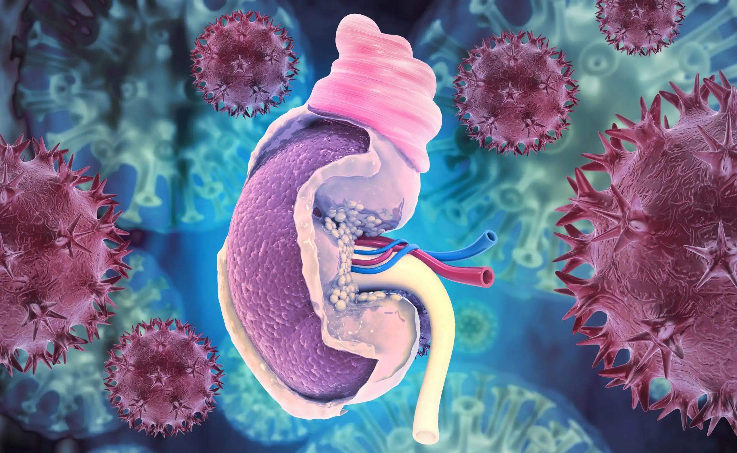 Viral Infection of Cancerous Cells in Urinary System