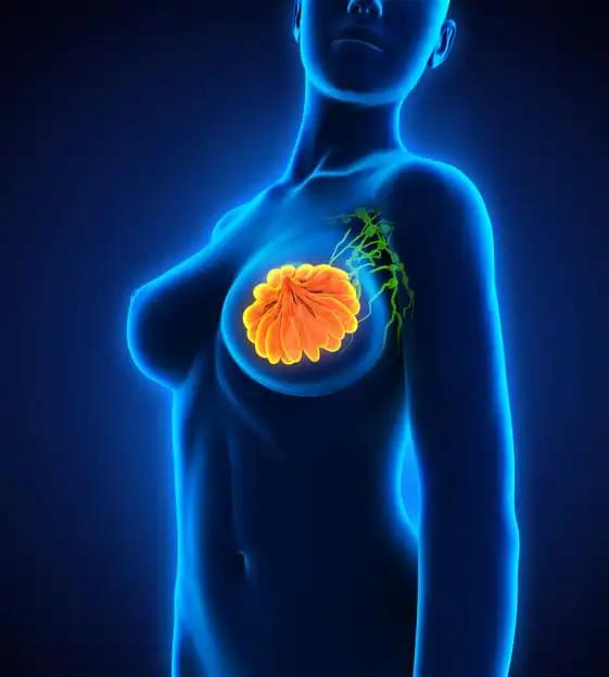 Breast Tissue Stiffening Breast Cancer