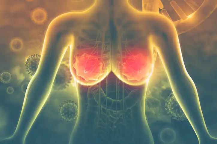 Chemotherapy in Early Her2-Positive Breast Cancer