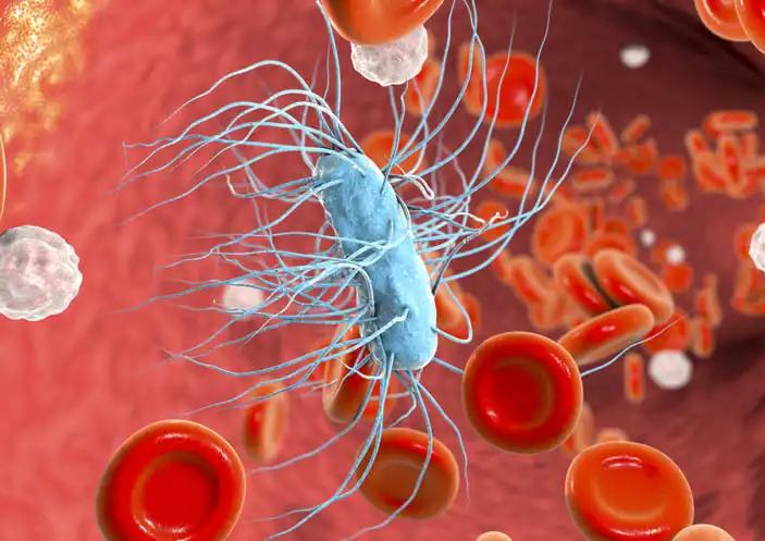 3D illustration Sepsis Bacteremia