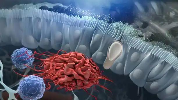 Innate Lymphoid Cells 