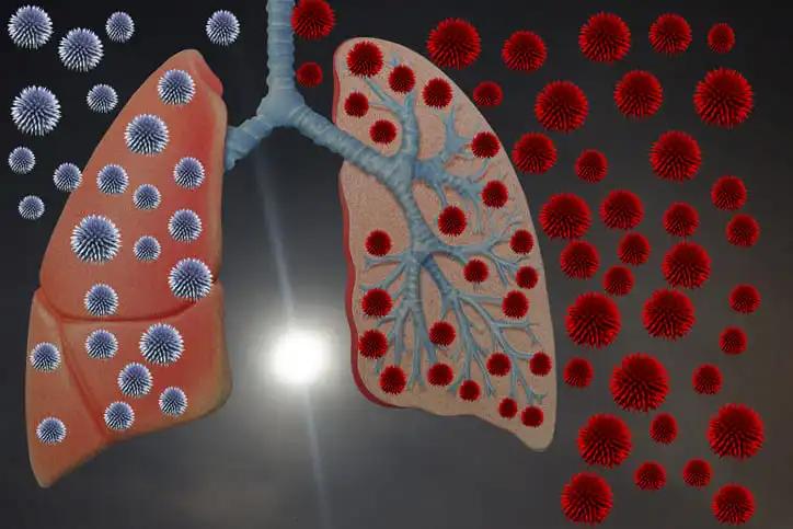 Viral Infection of Airborne Virus in Lung 