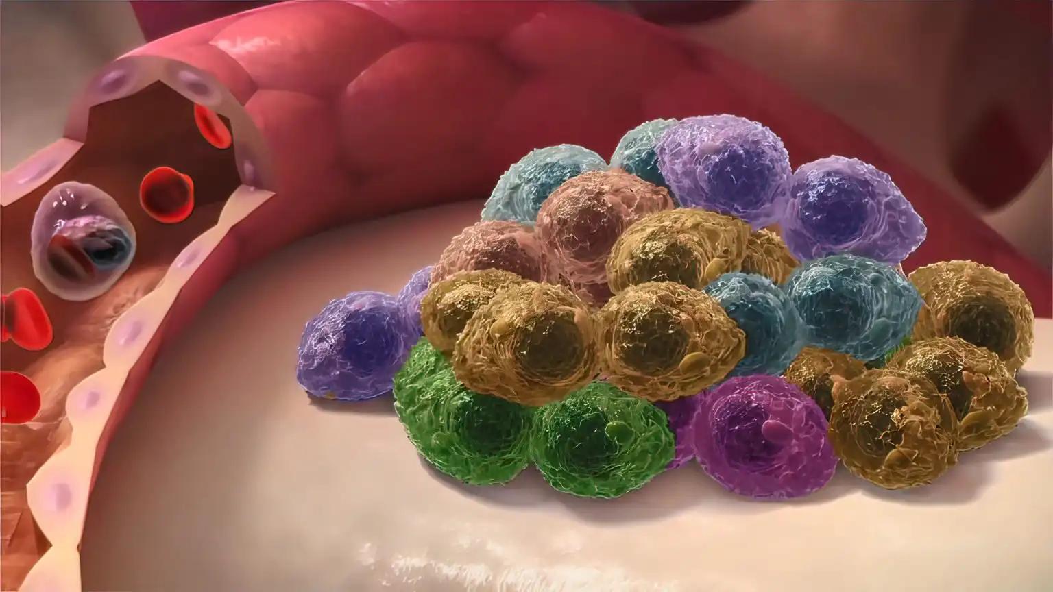 Multiple Myeloma Cells