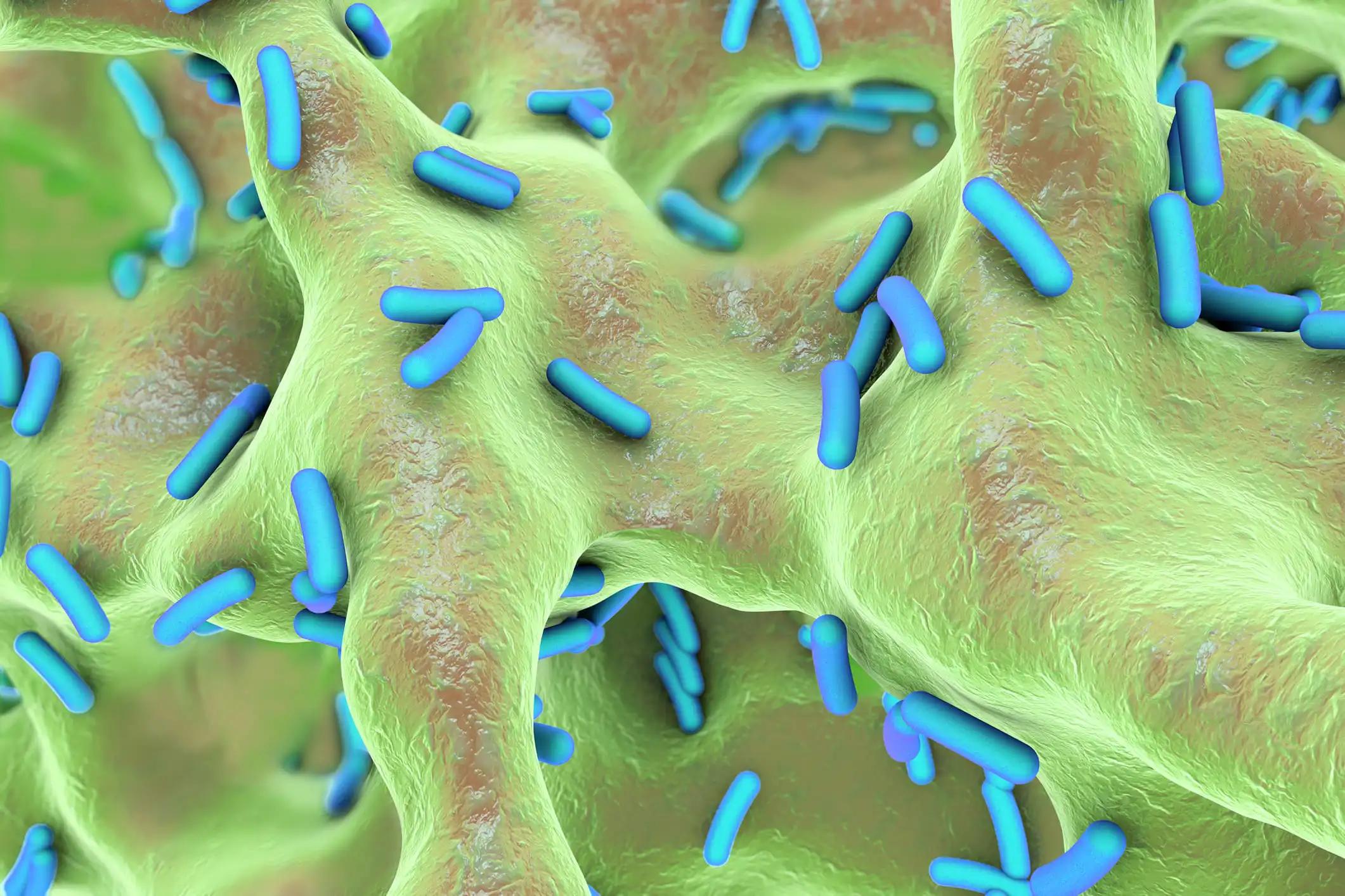 Visualizing Bacterial Invasion of Bone in 3D