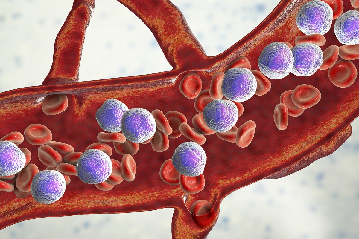 3D illustration of Abundant Lymphoblasts in Blood