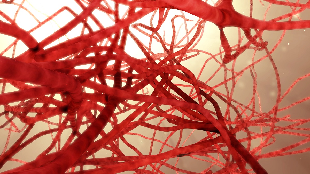 3d illustration Blood Vessel of T-Cell Lymphoma