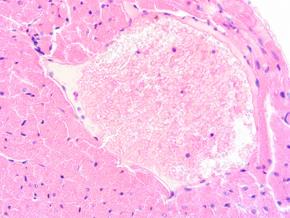 Microscope View of Histology of Human Heart Tissue