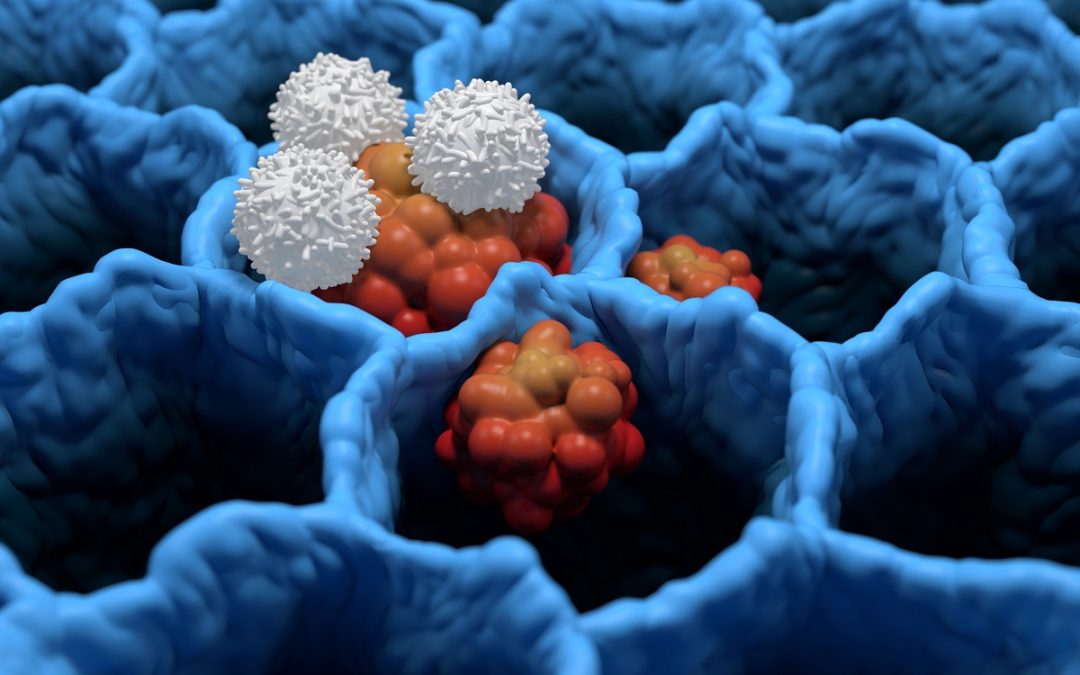 Firmonertinib in TKI-Naive EGFR PACC+ NSCLC