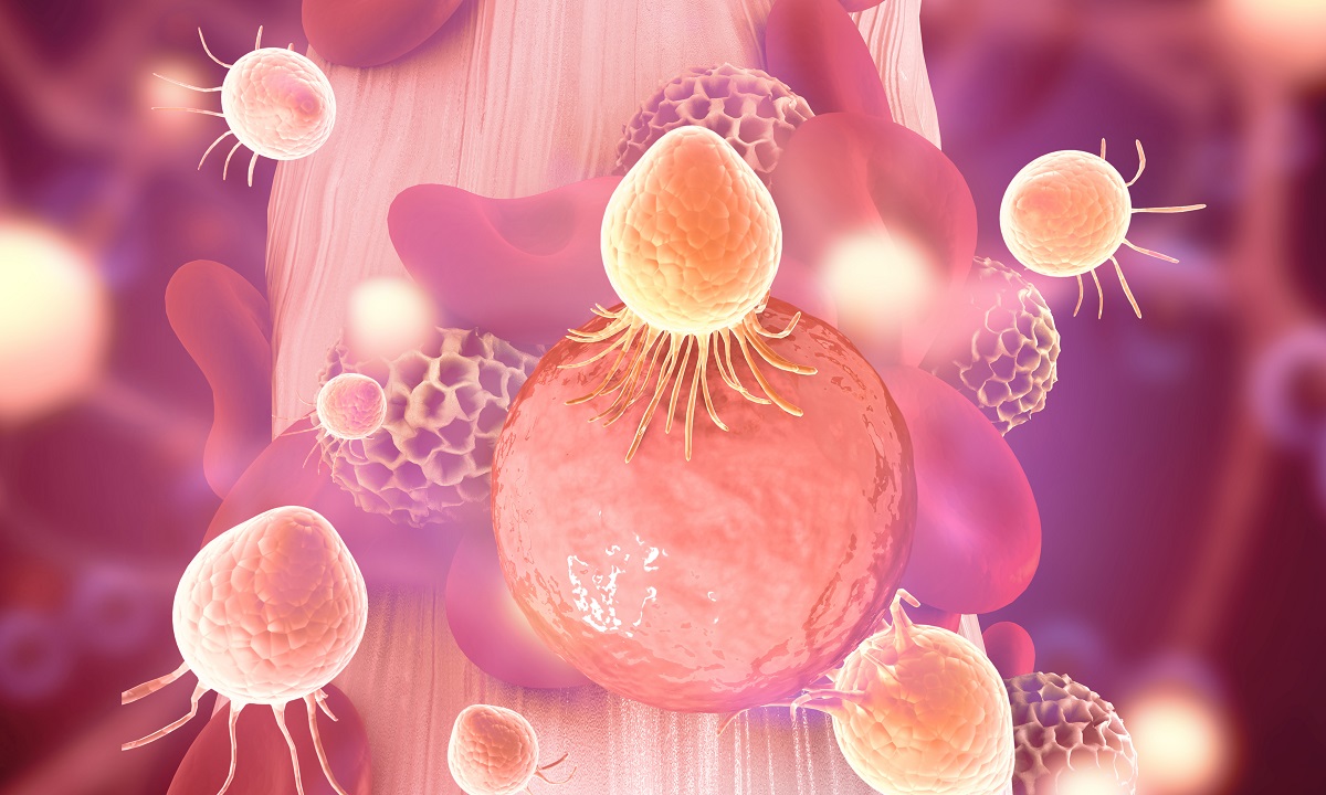 3d illustration of NSCLC Tumor Cells Spread