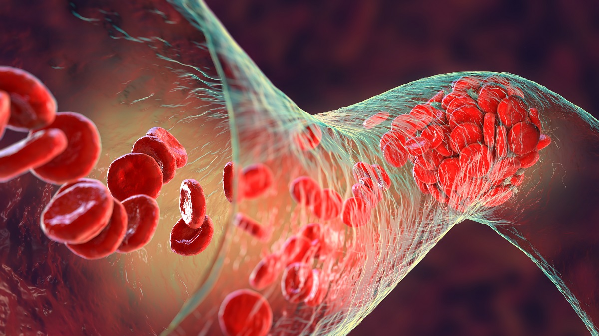 T Cell Activity Against NSCLC Tumors