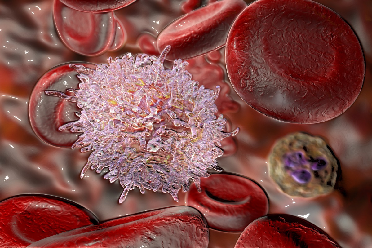 3D illustration of Lymphocyte in Hairy Cell Leukaemia