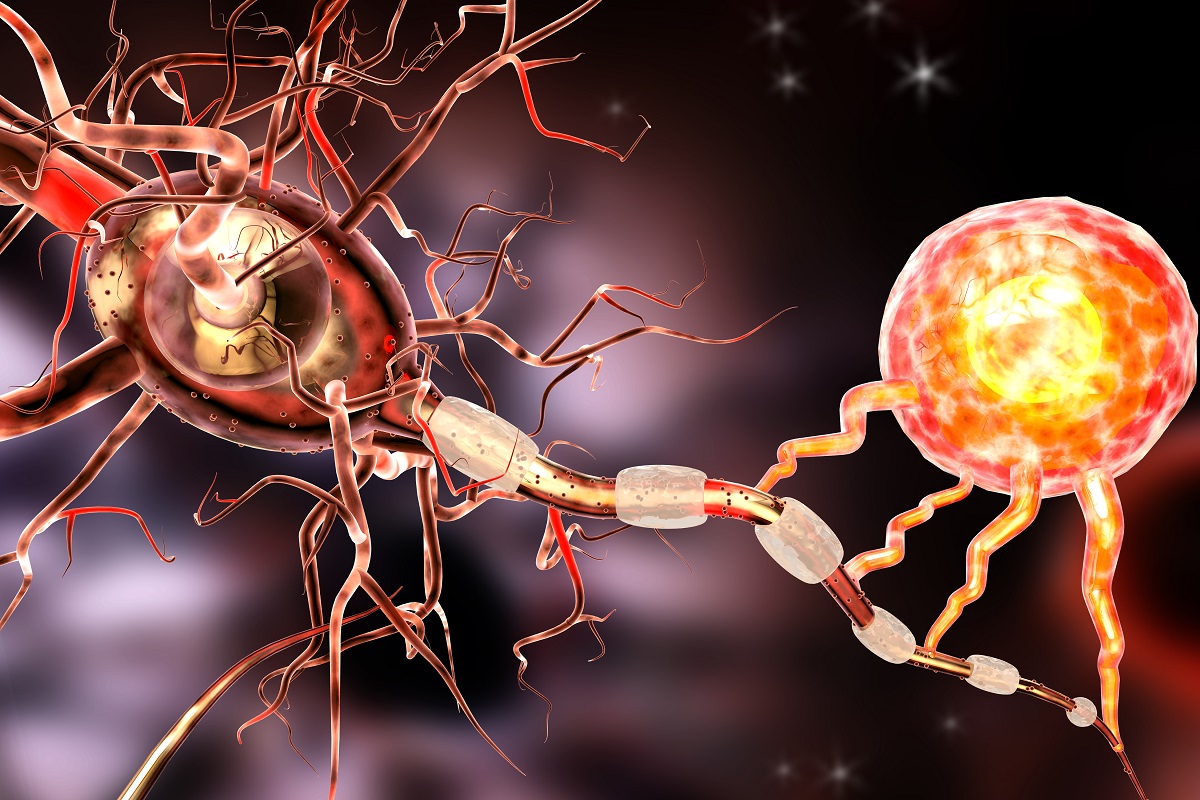 3D illustration of Heavily Pretreated HNC Showing Antitumor Activity