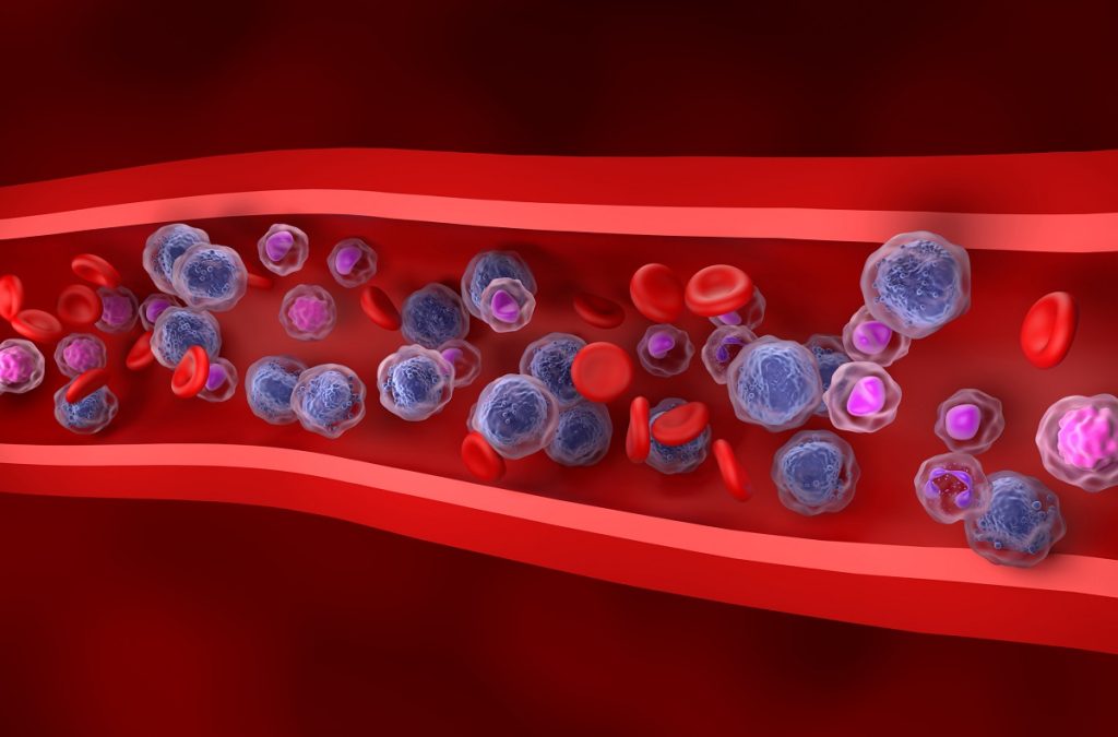 3d illustration of Acute Myeloid Leukemia Cells in Blood Flow