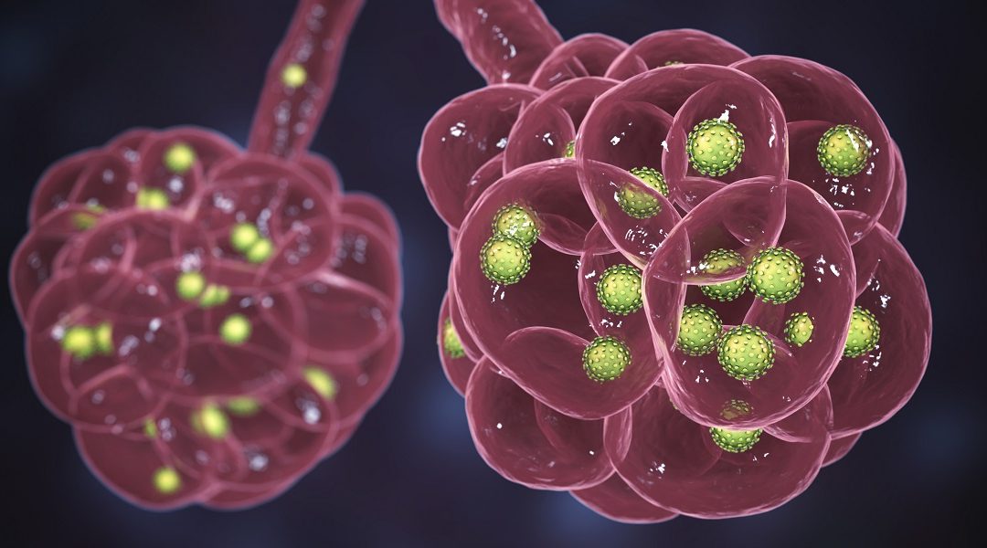 Clinicopathological Value of Gut Microbial Subtypes in CRC